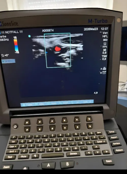 Echographe Sonosite m turbo