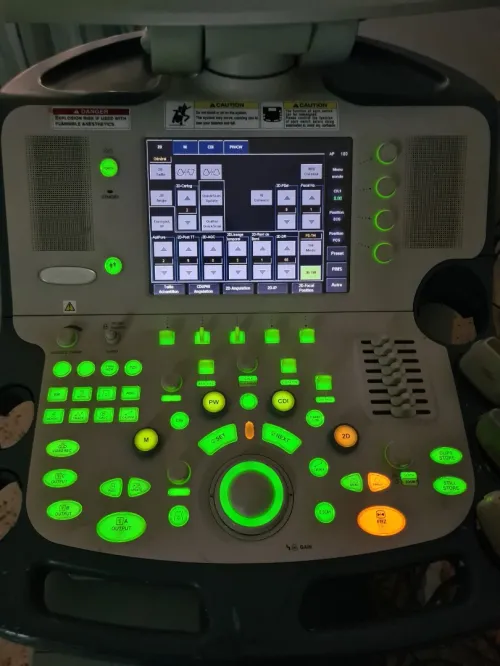 Échographe toshiba xario 