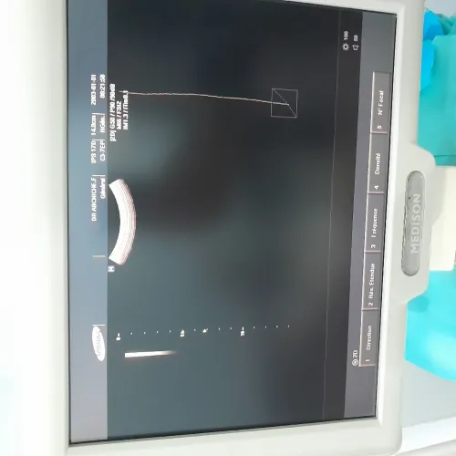 ECHOGRAPHE SONACE X6 MEDISON avec doppler