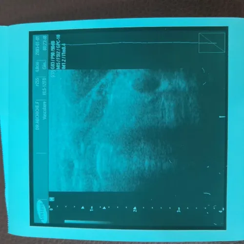 ECHOGRAPHE SONACE X6 MEDISON avec doppler