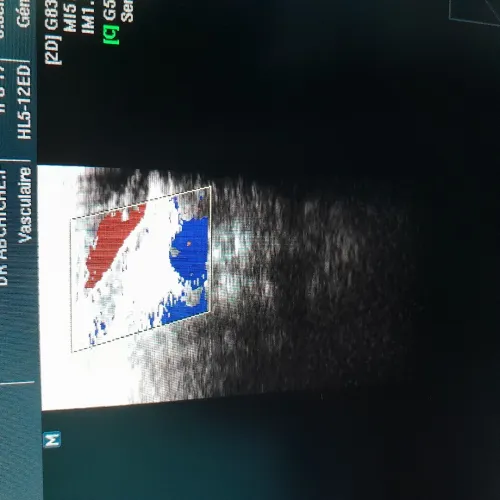 ECHOGRAPHE SONACE X6 MEDISON avec doppler