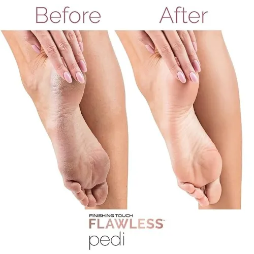 جهاز ازالة تشققات القدمين و الجلد الميت Flawless Pedi
