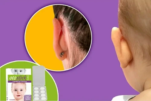 Correcteur Otostick Oreilles décollées Qualité européenne
