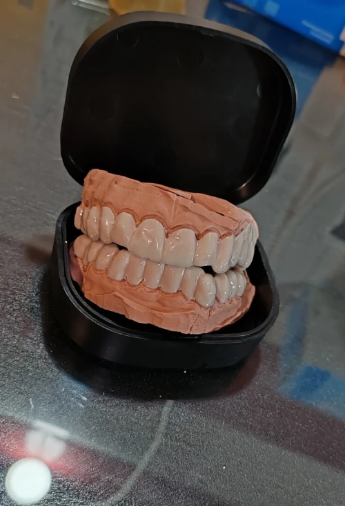 Snap on smile Germany