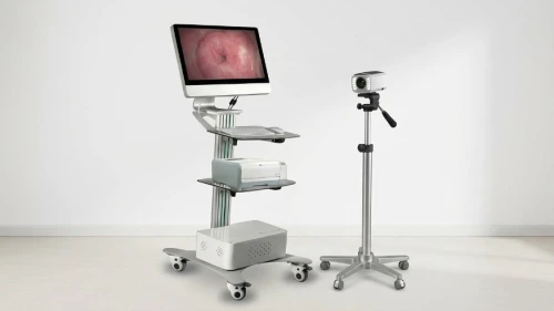 Gynecology Video Colposcope