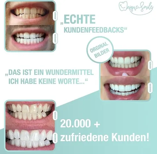 Unique smile