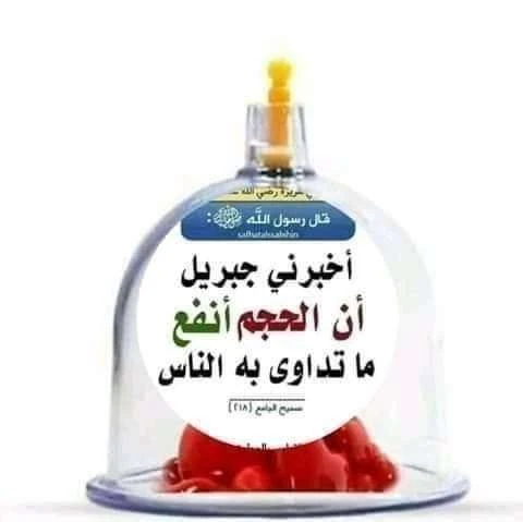 Hidjama-الحجامة الوقائية والعلاجية للرجال والنساء