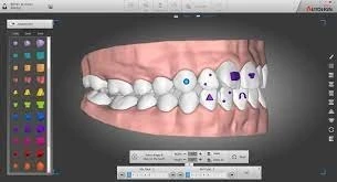 Autolign 3d Diorco 2022