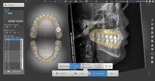 Autolign 3d Diorco 2022