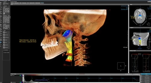 OnDemand3D Dental 2022