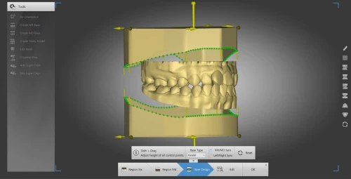 Autolign 3d Diorco 2022