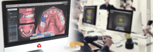 Autolign 3d Diorco 2022