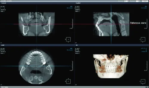 OnDemand3D Dental 2022
