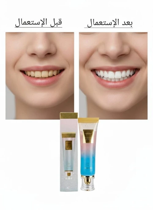 Dentifrice معجون لتبييض الأسنان