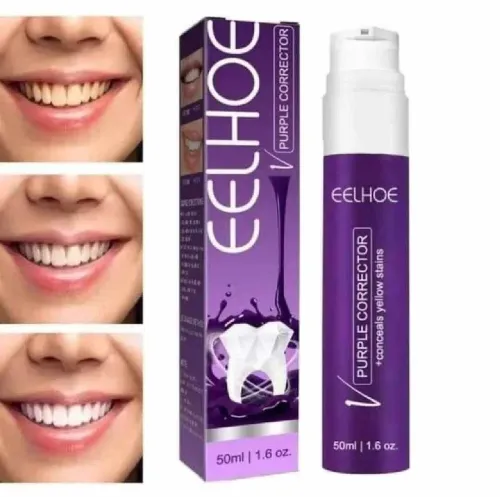 مبيض الأسنان eelhoe