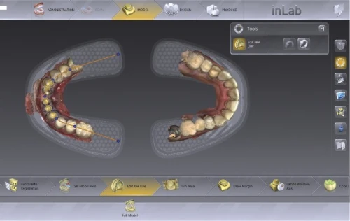 InLab CAD SW 22.1