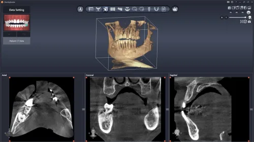 DentiqGuide 