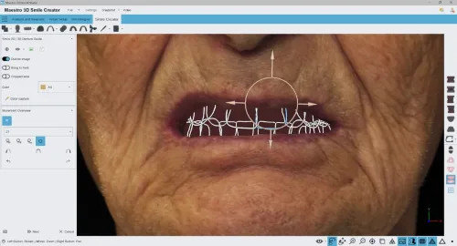 Maestro 3D Dental Studio V6