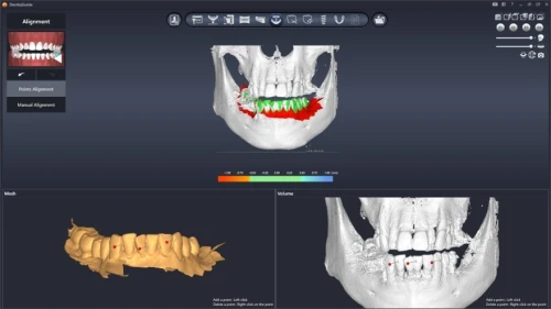 DentiqGuide 