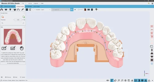 Maestro 3D Dental Studio V6