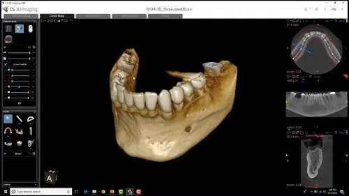 CS 3D Imaging 3.10.21