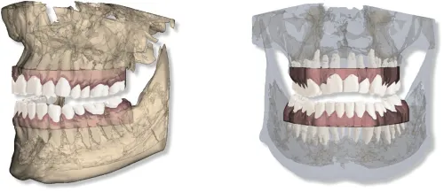 Maestro 3D Dental Studio V6