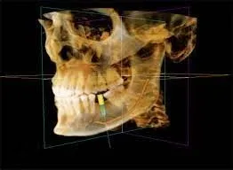 CS 3D Imaging 3.10.21