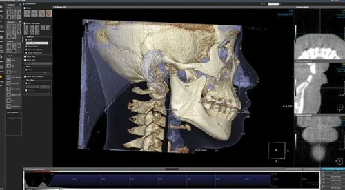 OnDemand3D Dental 2024