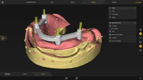 InLab CAD SW 22.1