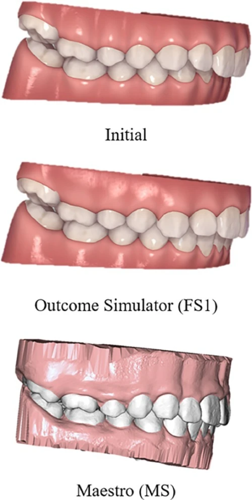 Diorco Autolign 3D 1.6.4.3