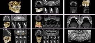 CS 3D Imaging 3.10.21
