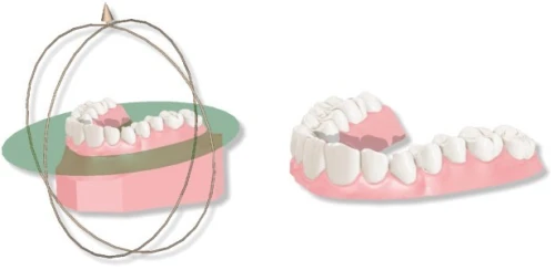 Maestro 3D Dental Studio V6