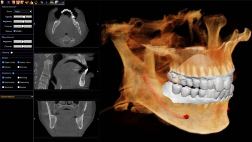 CS 3D Imaging 3.10.21