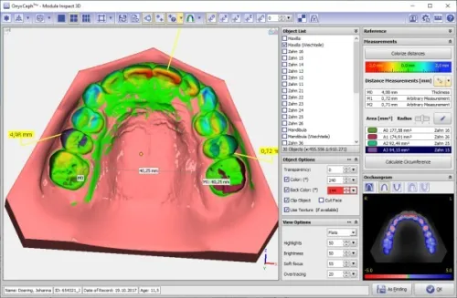 OnyxCeph 2025 (Build 3.2.233)