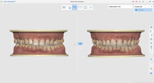 Diorco Autolign 3D 1.6.4.3