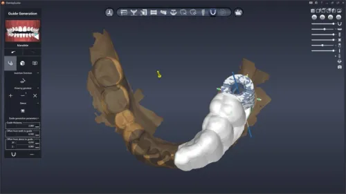 DentiqGuide 