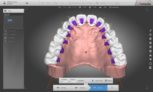 Diorco Autolign 3D 1.6.4.3