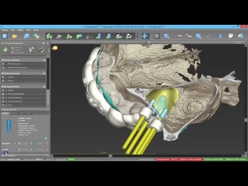 coDiagnostiX v10.9 (2025)