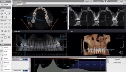 OnDemand3D Dental 2024
