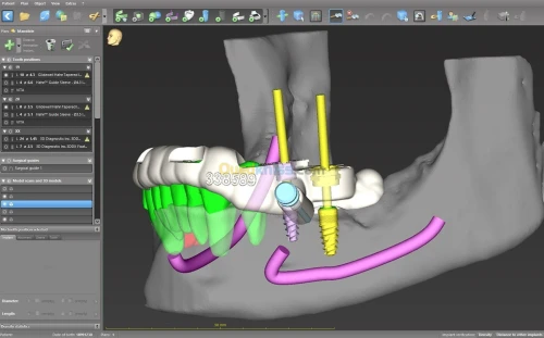 coDiagnostiX v10.9 (2025)