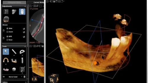 CS 3D Imaging 3.10.21
