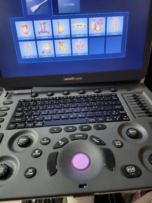 Echographe Sonoscape E2