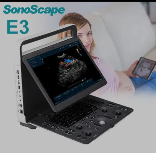 Échographe SonoScape E3
