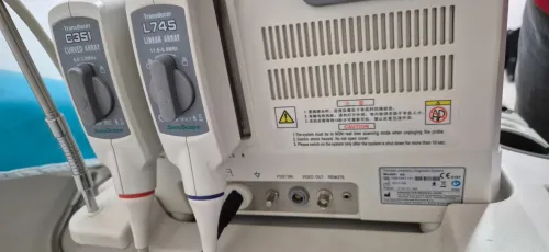 Echographe sonoscape A6