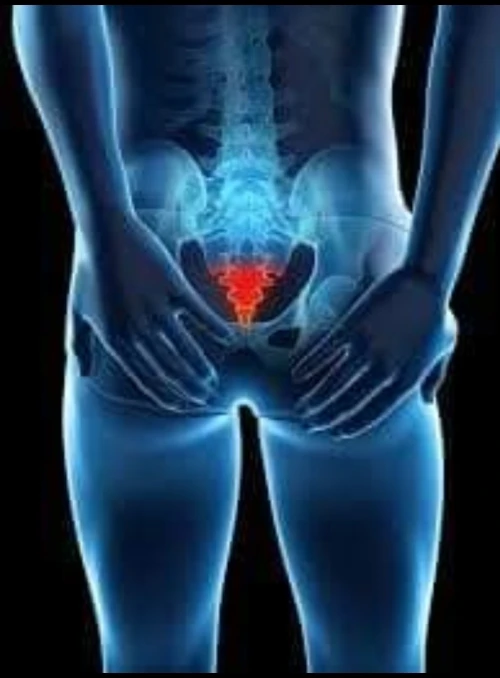 Coussin coccyx pour mal de dos 