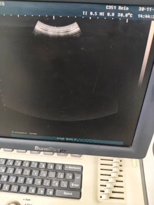 Sonoscape A6 bon état