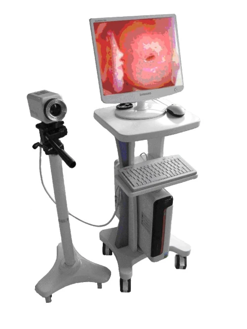 Coloscope électronique vidéo numérique Leo 2100I