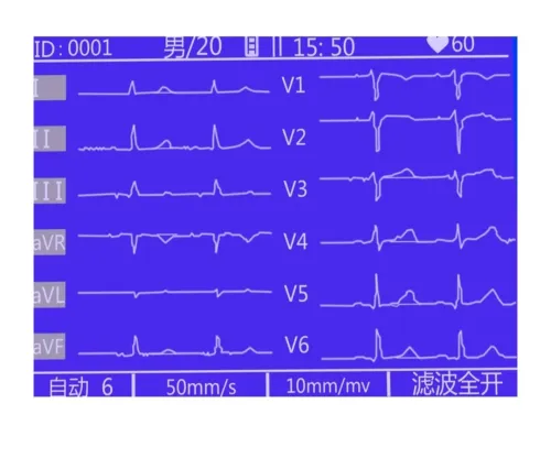 Appareil ECG 6 canales _ECG1206