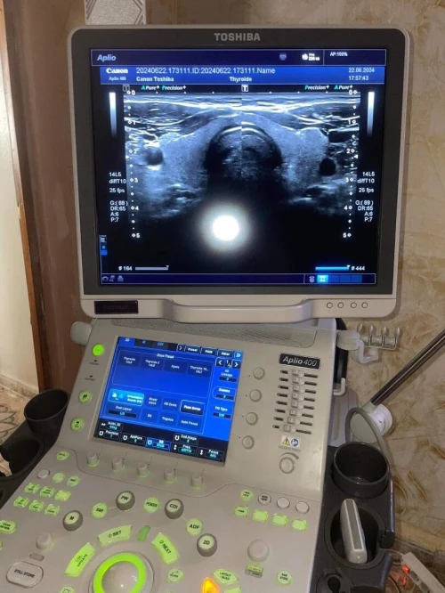ECHOGRAPHE TOSHIBA APLIO 400