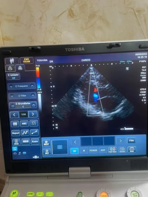 Echographe portatif TOSHIBA VIAMO
